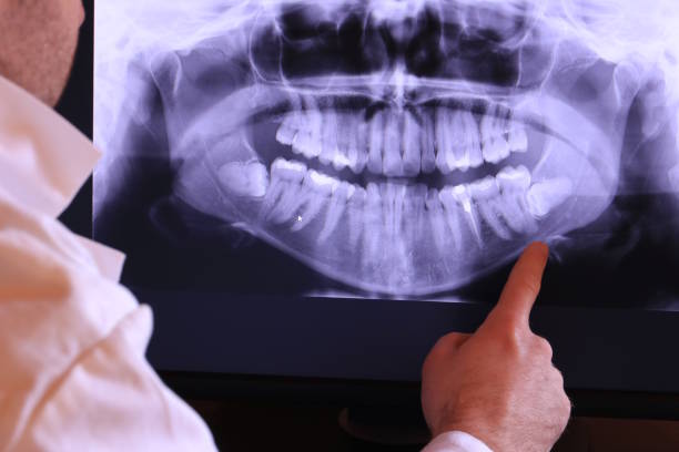 Best Emergency Dentist for Lost Fillings or Crowns in Trumbull Center, CT