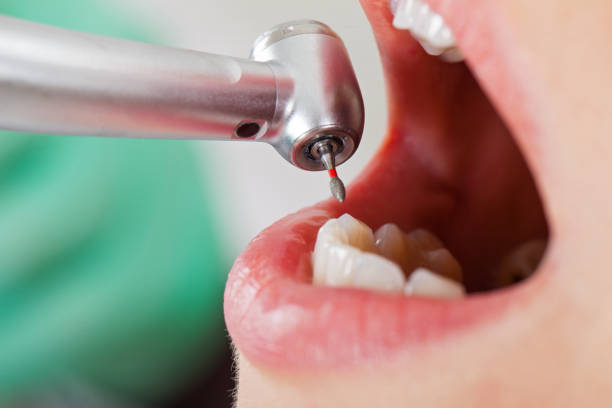 Best Emergency Dentist for Knocked-Out Tooth in Trumbull Center, CT